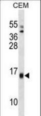 SAA4 Antibody western blot of CEM cell line lysates (35 ug/lane). The SAA4 antibody detected the SAA4 protein (arrow).