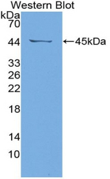 Western blot of recombinant SAA4.