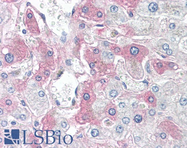 Anti-SAA4 antibody IHC of human liver. Immunohistochemistry of formalin-fixed, paraffin-embedded tissue after heat-induced antigen retrieval. Antibody LS-B8092 dilution 5-10 ug/ml.