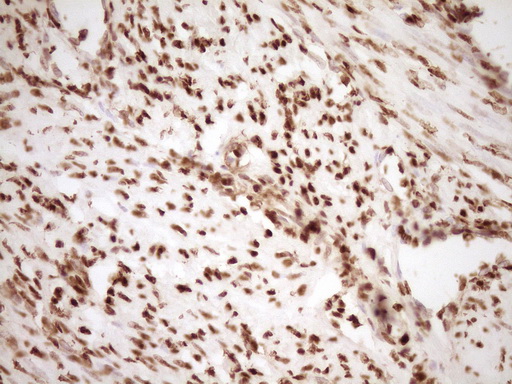 IHC of paraffin-embedded Human endometrium tissue using anti-SAE1 mouse monoclonal antibody. (Heat-induced epitope retrieval by 1 mM EDTA in 10mM Tris, pH8.5, 120°C for 3min).