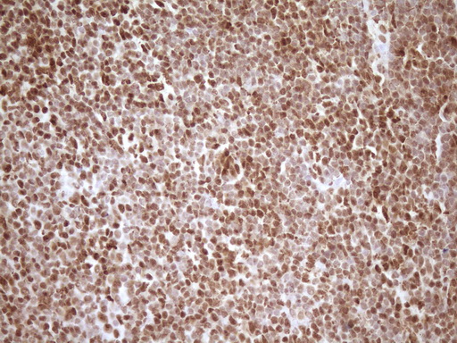 IHC of paraffin-embedded Human tonsil using anti-SAE1 mouse monoclonal antibody. (Heat-induced epitope retrieval by 1 mM EDTA in 10mM Tris, pH8.5, 120°C for 3min).