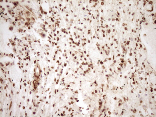 IHC of paraffin-embedded Human lymph node tissue using anti-SAE1 mouse monoclonal antibody. (Heat-induced epitope retrieval by 1 mM EDTA in 10mM Tris, pH8.5, 120°C for 3min).