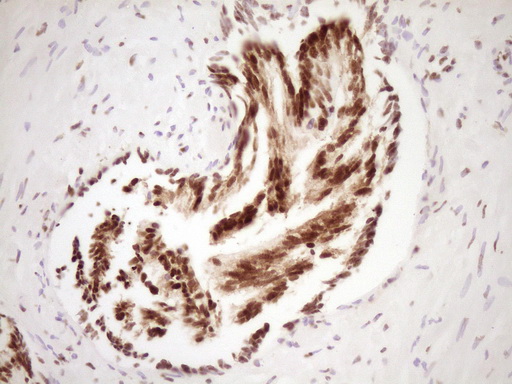 IHC of paraffin-embedded Human prostate tissue using anti-SAE1 mouse monoclonal antibody. (Heat-induced epitope retrieval by 1 mM EDTA in 10mM Tris, pH8.5, 120°C for 3min).