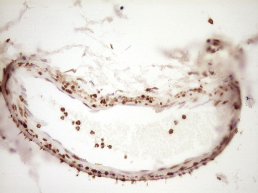 IHC of paraffin-embedded Human bladder tissue using anti-SAE1 mouse monoclonal antibody. (Heat-induced epitope retrieval by 1 mM EDTA in 10mM Tris, pH8.5, 120°C for 3min).