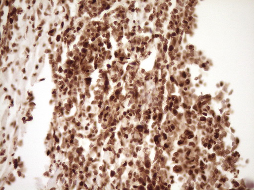 IHC of paraffin-embedded Human colon tissue using anti-SAE1 mouse monoclonal antibody. (Heat-induced epitope retrieval by 1 mM EDTA in 10mM Tris, pH8.5, 120°C for 3min).