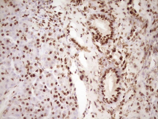 IHC of paraffin-embedded Human pancreas tissue using anti-SAE1 mouse monoclonal antibody. (Heat-induced epitope retrieval by 1 mM EDTA in 10mM Tris, pH8.5, 120°C for 3min).