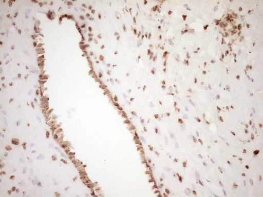 IHC of paraffin-embedded Human Ovary tissue using anti-SAE1 mouse monoclonal antibody. (Heat-induced epitope retrieval by 1 mM EDTA in 10mM Tris, pH8.5, 120°C for 3min).