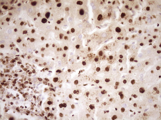 IHC of paraffin-embedded Human liver tissue using anti-SAE1 mouse monoclonal antibody. (Heat-induced epitope retrieval by 1 mM EDTA in 10mM Tris, pH8.5, 120°C for 3min).