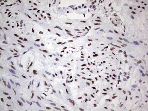 IHC of paraffin-embedded Human endometrium tissue using anti-SAE1 mouse monoclonal antibody. (Heat-induced epitope retrieval by 1 mM EDTA in 10mM Tris, pH8.5, 120°C for 3min).