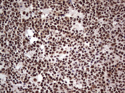 IHC of paraffin-embedded Human tonsil using anti-SAE1 mouse monoclonal antibody. (Heat-induced epitope retrieval by 1 mM EDTA in 10mM Tris, pH8.5, 120°C for 3min).