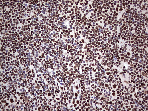 IHC of paraffin-embedded Human lymph node tissue using anti-SAE1 mouse monoclonal antibody. (Heat-induced epitope retrieval by 1 mM EDTA in 10mM Tris, pH8.5, 120°C for 3min).