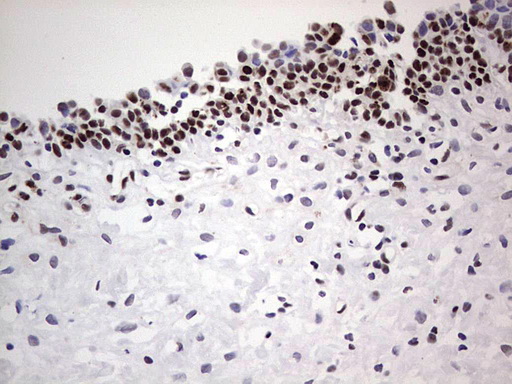 IHC of paraffin-embedded Human bladder tissue using anti-SAE1 mouse monoclonal antibody. (Heat-induced epitope retrieval by 1 mM EDTA in 10mM Tris, pH8.5, 120°C for 3min).