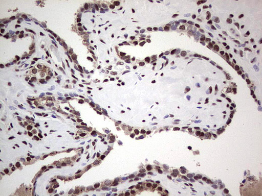 IHC of paraffin-embedded Human prostate tissue using anti-SAE1 mouse monoclonal antibody. (Heat-induced epitope retrieval by 1 mM EDTA in 10mM Tris, pH8.5, 120°C for 3min).