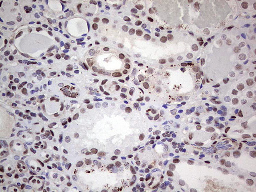 IHC of paraffin-embedded Human Kidney tissue using anti-SAE1 mouse monoclonal antibody. (Heat-induced epitope retrieval by 1 mM EDTA in 10mM Tris, pH8.5, 120°C for 3min).