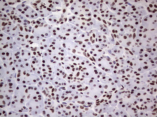 IHC of paraffin-embedded Human pancreas tissue using anti-SAE1 mouse monoclonal antibody. (Heat-induced epitope retrieval by 1 mM EDTA in 10mM Tris, pH8.5, 120°C for 3min).