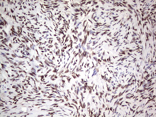 IHC of paraffin-embedded Human Ovary tissue using anti-SAE1 mouse monoclonal antibody. (Heat-induced epitope retrieval by 1 mM EDTA in 10mM Tris, pH8.5, 120°C for 3min).