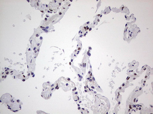IHC of paraffin-embedded Human lung tissue using anti-SAE1 mouse monoclonal antibody. (Heat-induced epitope retrieval by 1 mM EDTA in 10mM Tris, pH8.5, 120°C for 3min).