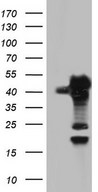 HEK293T cells were transfected with the pCMV6-ENTRY control (Left lane) or pCMV6-ENTRY SAE1 (Right lane) cDNA for 48 hrs and lysed. Equivalent amounts of cell lysates (5 ug per lane) were separated by SDS-PAGE and immunoblotted with anti-SAE1.