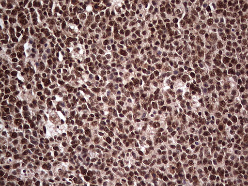 IHC of paraffin-embedded Human tonsil using anti-SAE1 mouse monoclonal antibody. (Heat-induced epitope retrieval by 1 mM EDTA in 10mM Tris, pH8.5, 120°C for 3min).