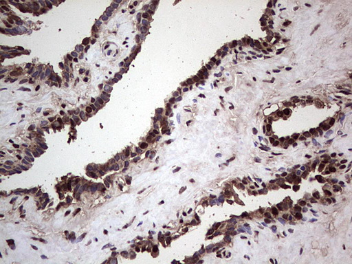 IHC of paraffin-embedded Human prostate tissue using anti-SAE1 mouse monoclonal antibody. (Heat-induced epitope retrieval by 1 mM EDTA in 10mM Tris, pH8.5, 120°C for 3min).