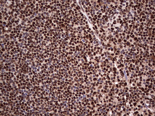 IHC of paraffin-embedded Human lymph node tissue using anti-SAE1 mouse monoclonal antibody. (Heat-induced epitope retrieval by 1 mM EDTA in 10mM Tris, pH8.5, 120°C for 3min).