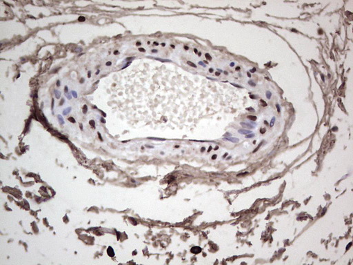 IHC of paraffin-embedded Human bladder tissue using anti-SAE1 mouse monoclonal antibody. (Heat-induced epitope retrieval by 1 mM EDTA in 10mM Tris, pH8.5, 120°C for 3min).