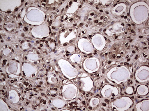 IHC of paraffin-embedded Human Kidney tissue using anti-SAE1 mouse monoclonal antibody. (Heat-induced epitope retrieval by 1 mM EDTA in 10mM Tris, pH8.5, 120°C for 3min).