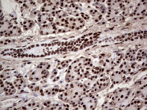 IHC of paraffin-embedded Human pancreas tissue using anti-SAE1 mouse monoclonal antibody. (Heat-induced epitope retrieval by 1 mM EDTA in 10mM Tris, pH8.5, 120°C for 3min).