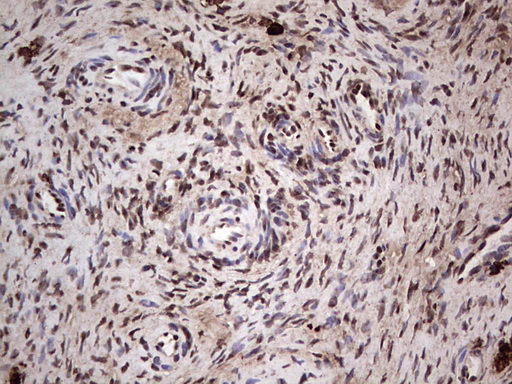 IHC of paraffin-embedded Human Ovary tissue using anti-SAE1 mouse monoclonal antibody. (Heat-induced epitope retrieval by 1 mM EDTA in 10mM Tris, pH8.5, 120°C for 3min).