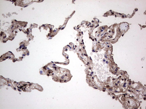 IHC of paraffin-embedded Human lung tissue using anti-SAE1 mouse monoclonal antibody. (Heat-induced epitope retrieval by 1 mM EDTA in 10mM Tris, pH8.5, 120°C for 3min).