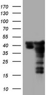 HEK293T cells were transfected with the pCMV6-ENTRY control (Left lane) or pCMV6-ENTRY SAE1 (Right lane) cDNA for 48 hrs and lysed. Equivalent amounts of cell lysates (5 ug per lane) were separated by SDS-PAGE and immunoblotted with anti-SAE1.