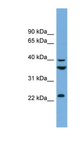 SAE1 antibody LS-C111369 Western blot of HeLa lysate.