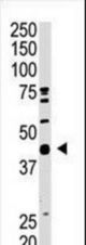 The AOS1 C-term antibody is used in Western blot to detect AOS1 in mouse heart tissue lysate.