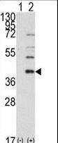 Western blot of AOS1 (arrow) using rabbit polyclonal AOS1 Antibody. 293 cell lysates (2 ug/lane) either nontransfected (Lane 1) or transiently transfected with the AOS1 gene (Lane 2) (Origene Technologies).