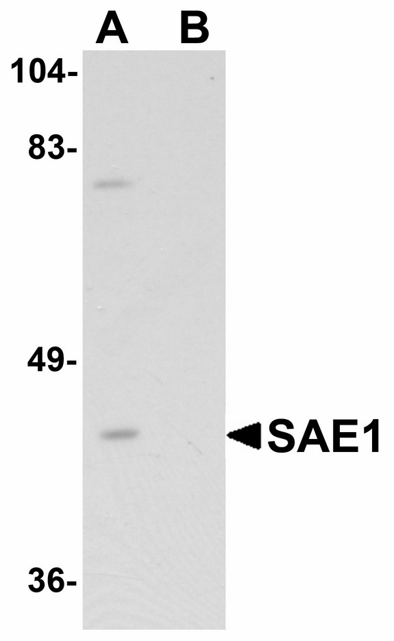 Western blot of SAE1 in SK-N-SH lysate with SAE1 antibody at 1 ug/ml in (A) the absence and (B) the presence of blocking peptide.