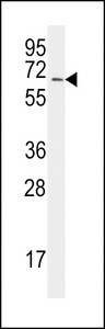The anti-UBA2 C-term E616 Antibody is used in Western blot to detect UBA2 in Jurkat lysate.