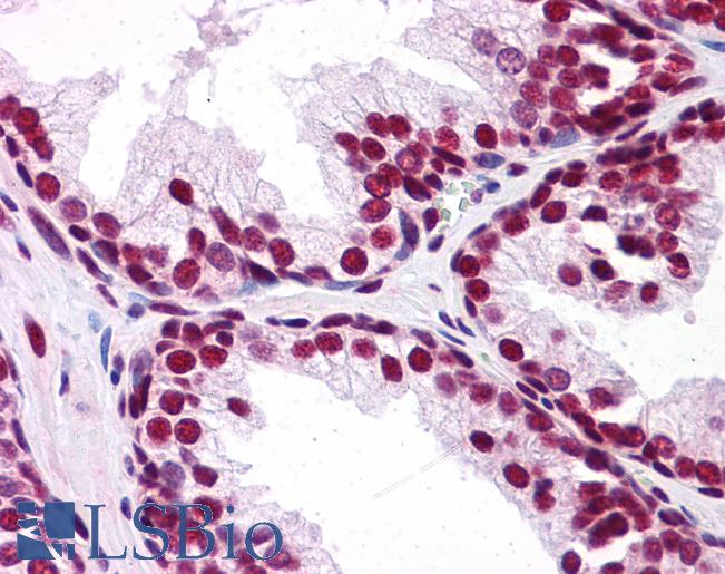 Anti-UBA2 antibody IHC of human prostate. Immunohistochemistry of formalin-fixed, paraffin-embedded tissue after heat-induced antigen retrieval. Antibody LS-B5092 concentration 5 ug/ml.