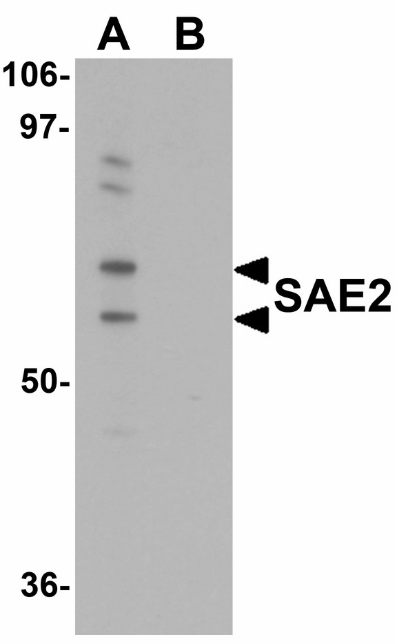 Western blot of SAE2 in 293 cell lysate with SAE2 antibody at 0.25 ug/ml in (A) the absence and (B) the presence of blocking peptide.