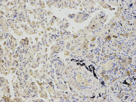 Immunohistochemistry of paraffin-embedded human lung using AHCY antibody at dilution of 1:200 (200x lens).