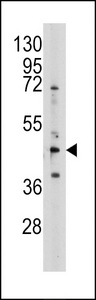 Western blot of anti-AHCY antibody in 293 cell line lysates (35 ug/lane). AHCY (arrow) was detected using the purified antibody.