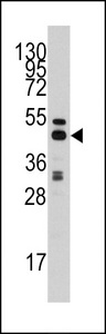 Western blot of anti-AHCY Antibody in HepG2 cell line lysates (35 ug/lane). AHCY(arrow) was detected using the purified antibody.