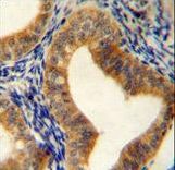 AHCY Antibody immunohistochemistry of formalin-fixed and paraffin-embedded human uterus tissue followed by peroxidase-conjugated secondary antibody and DAB staining.