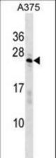 SARNP Antibody western blot of A375 cell line lysates (35 ug/lane). The SARNP antibody detected the SARNP protein (arrow).