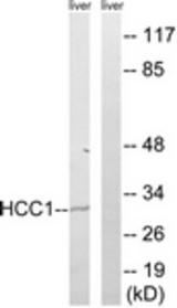 Western blot of extracts from mouse liver cells, using HCC1 Antibody. The lane on the right was incubated with synthetic peptide.