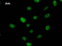 Immunostaining analysis in HeLa cells. HeLa cells were fixed with 4% paraformaldehyde and permeabilized with 0.1% Triton X-100 in PBS. The cells were immunostained with anti-CIP29 mAb.