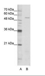 A: Marker, B: Jurkat Cell Lysate