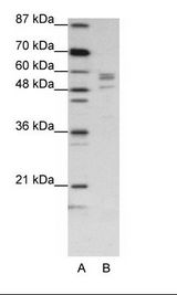 A: Marker, B: Jurkat Cell Lysate