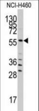 Western blot of anti-SARS Antibody in NCI-H460 cell line lysates (35 ug/lane). SARS(arrow) was detected using the purified antibody.
