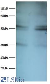 Western blot of SARS protein antibody at 2 ug/ml. Lane 1: EC109 whole cell lysate. Lane 2: 293T whole cell lysate. Secondary: Goat polyclonal to Rabbit IgG at 1:15000 dilution. Predicted band size: 56 kDa. Observed band size: 56 kDa Additional bands at: 36 kDa. We are unsure as to the identity of this extra band.