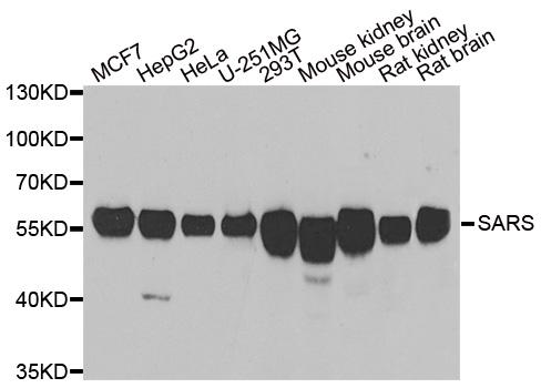 Western blot analysis of extracts of various cell lines, using SARS antibody.